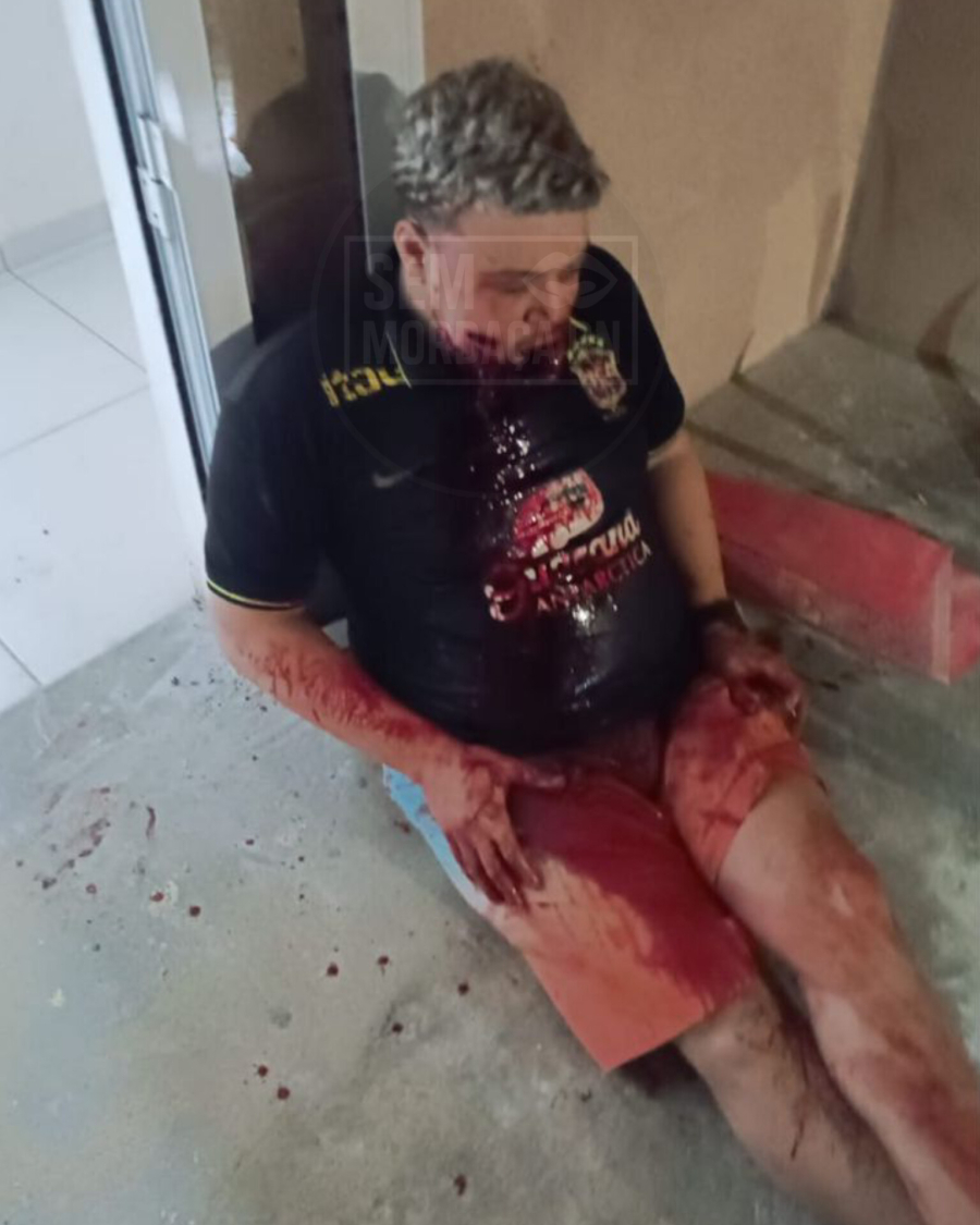 FOTOS: GUERRA ENTRE FACÇÕES DEIXE FACCIONADO BALEANDO NA BOCA EM NATAL 