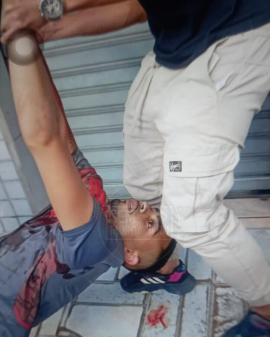 FOTOS EXCLUSIVAS: MORREU LACOSTE, MEMBRO DE FACÇÃO BALEADO EM MÃE LUIZA