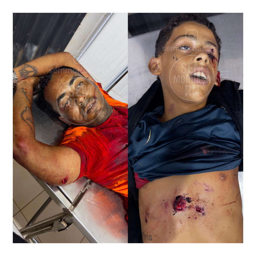 EXCLUSIVO: Fotos dos dois criminosos que tombaram em confronto com a equipe do tenente Higor, do 17º BPM